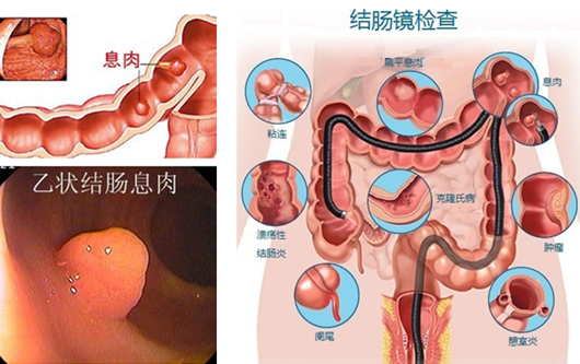 萎縮性胃炎真的“很嚇人”？看完這“七個(gè)事實(shí)”你就明白了