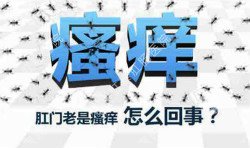 肛門瘙癢治不好嗎？先檢查病因就好辦！